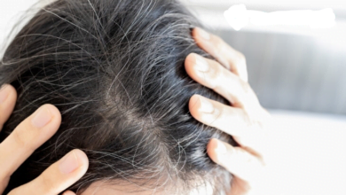 wellhealthorganic.com/know-the-causes-of-white-hair-and-easy-ways-to-prevent-it-naturally